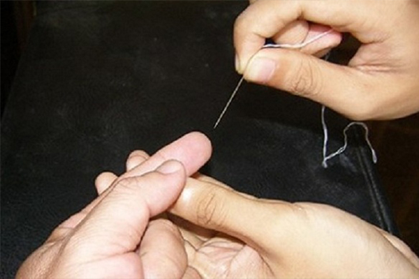 Sử dụng kim chích vào 10 đầu ngón tay để cứu bệnh nhân đột quỵ 